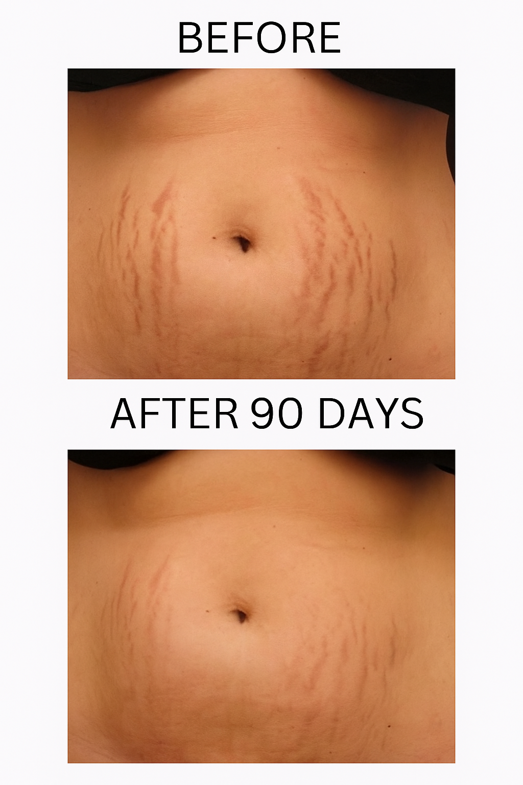 FADEE™ Stretch Marks & Loose Skin Patch ( 2 )